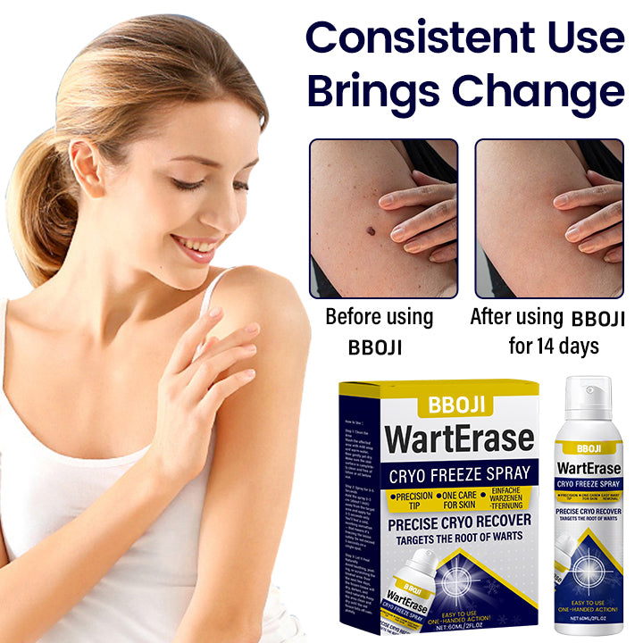 BBOJI® WartErase Cryo Freeze Spray