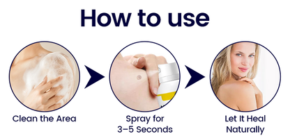 BBOJI® WartErase Cryo Freeze Spray