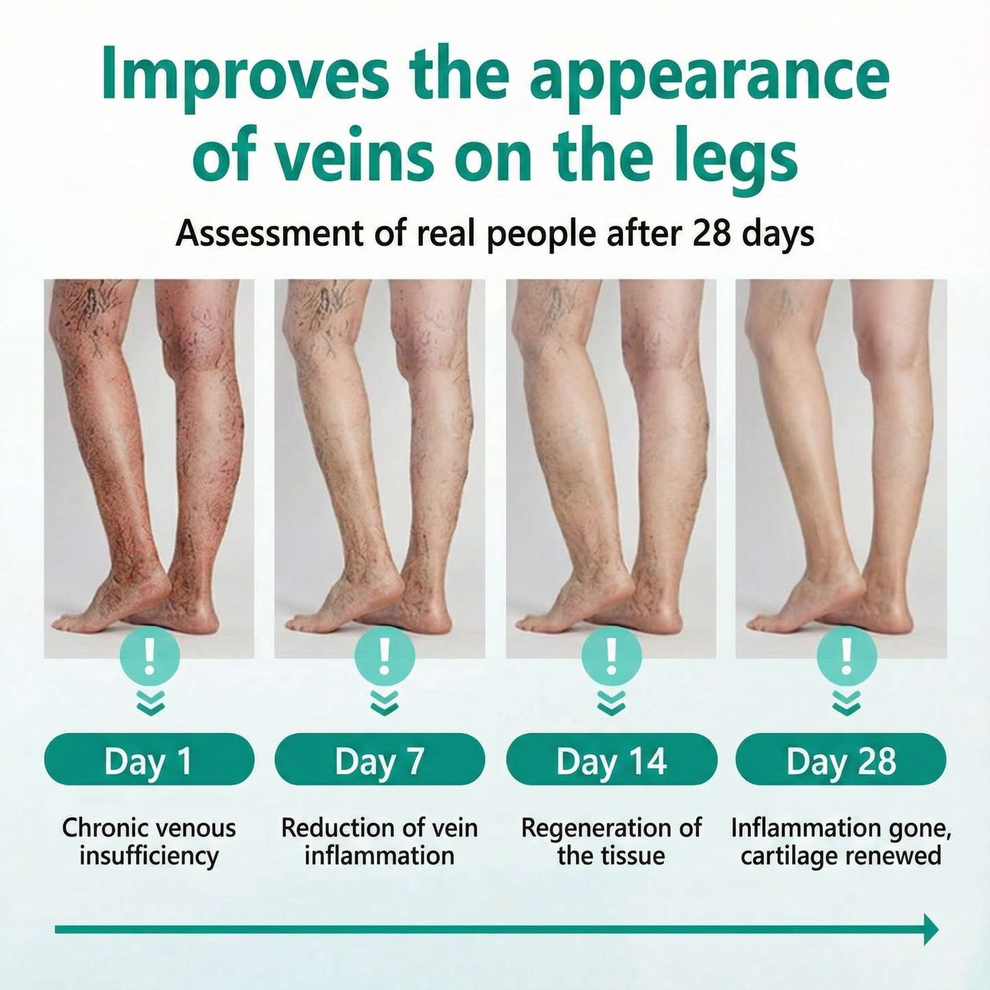 LOVILDS® LegRenew Patch for Varicose Veins Supports Vein Health & Helps Reduce Swelling — No Surgery