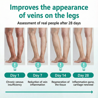 LOVILDS® LegRenew Patch for Varicose Veins Supports Vein Health & Helps Reduce Swelling — No Surgery