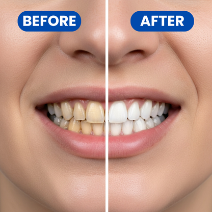 NESLEMY Teeth Whitening Strips - 7-Day Treatment with Non-Slip, Dry Strip Technology - Whitening Designed with Care for a Brighter Smile