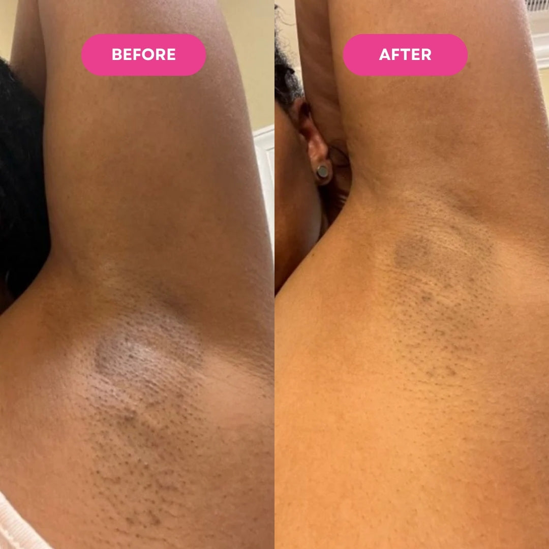 The Ancient Botanical Hair Serum for Smooth, Hair-Light Skin