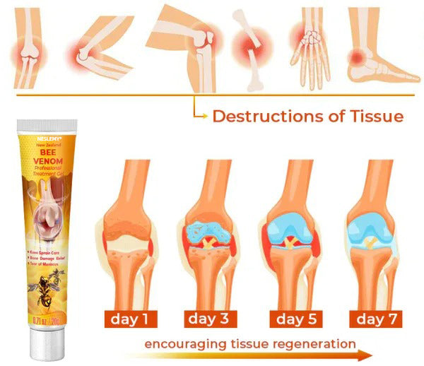 Advanced Bee Venom Gel for Everyday Joint Comfort