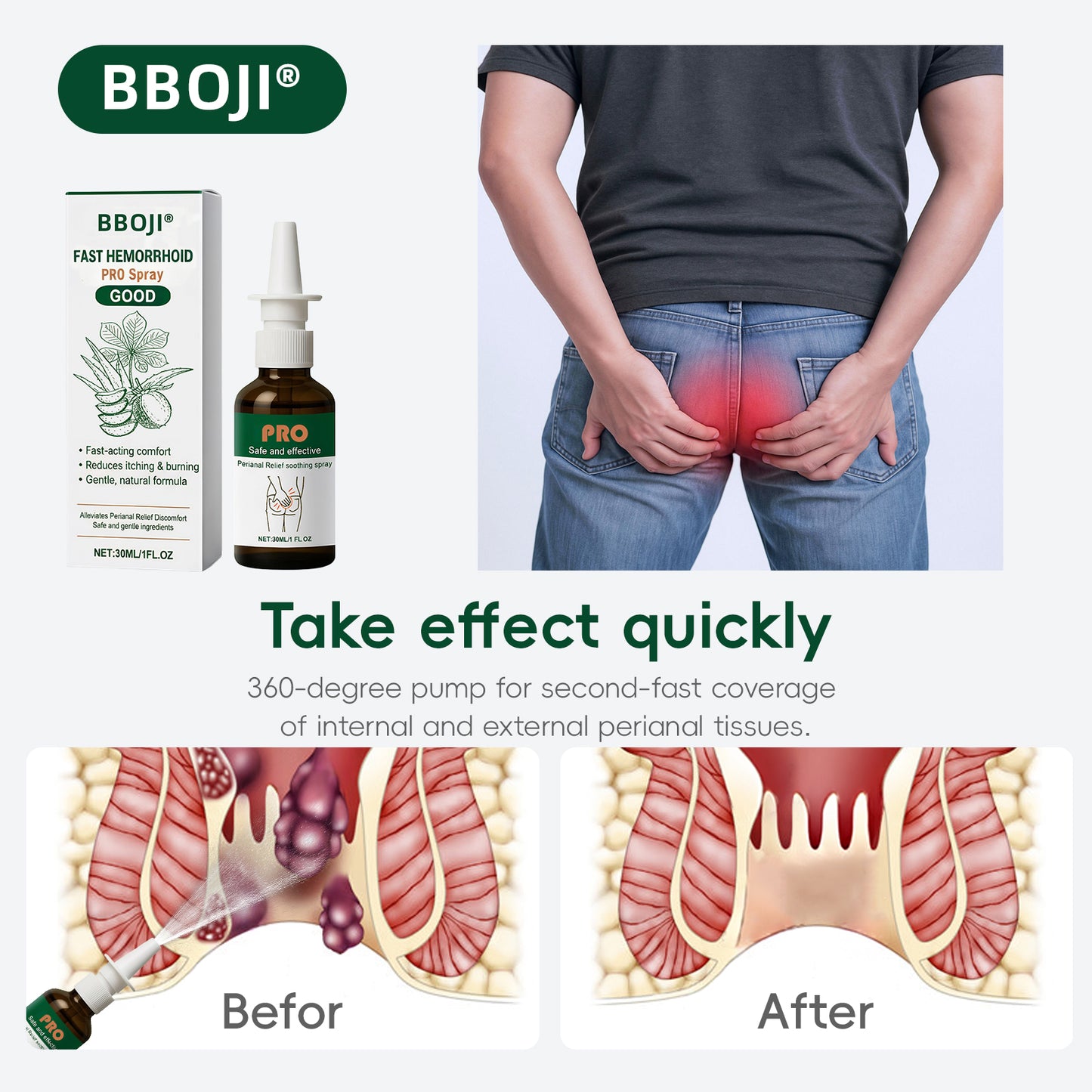 Fast-Acting Hemorrhoid Relief Spray for Itching, Burning & Swelling🍑