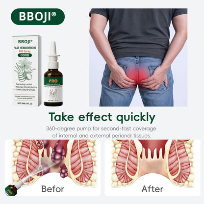 Fast-Acting Hemorrhoid Relief Spray for Itching, Burning & Swelling🍑