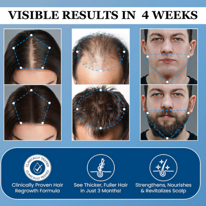 Hair Growth Roll-On Serum – Targeted Formula for Thicker, Fuller Hair in Just Weeks