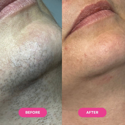 The Ancient Botanical Hair Serum for Smooth, Hair-Light Skin