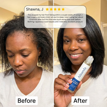 Hair Growth Roll-On Serum – Targeted Formula for Thicker, Fuller Hair in Just Weeks