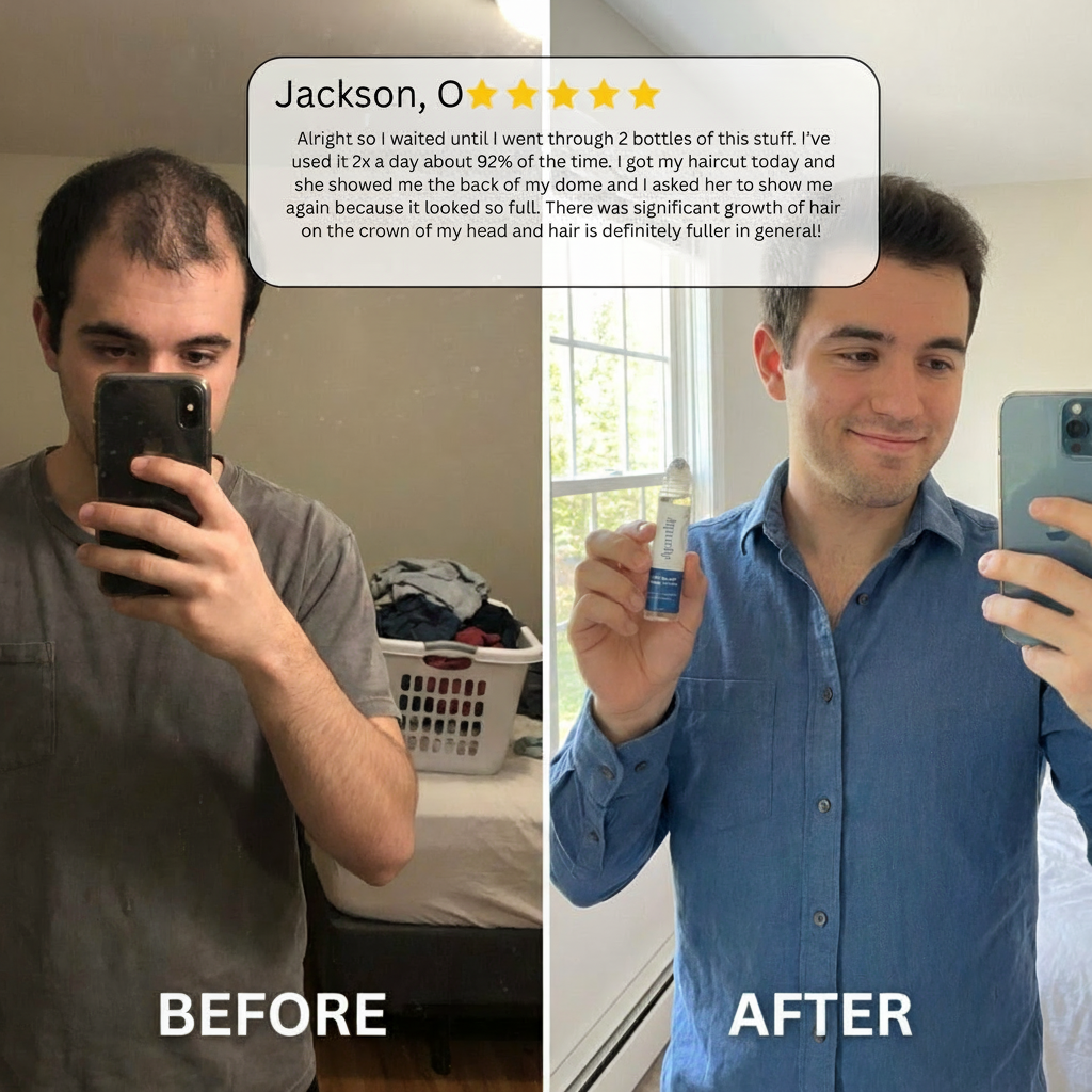 Hair Growth Roll-On Serum – Targeted Formula for Thicker, Fuller Hair in Just Weeks