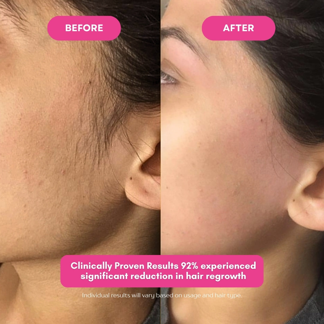 The Ancient Botanical Hair Serum for Smooth, Hair-Light Skin